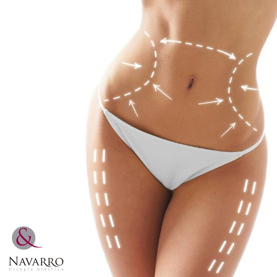 Before and After Result